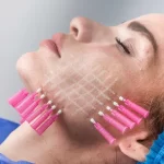 Hilos Revitalizantes. 10 unidades